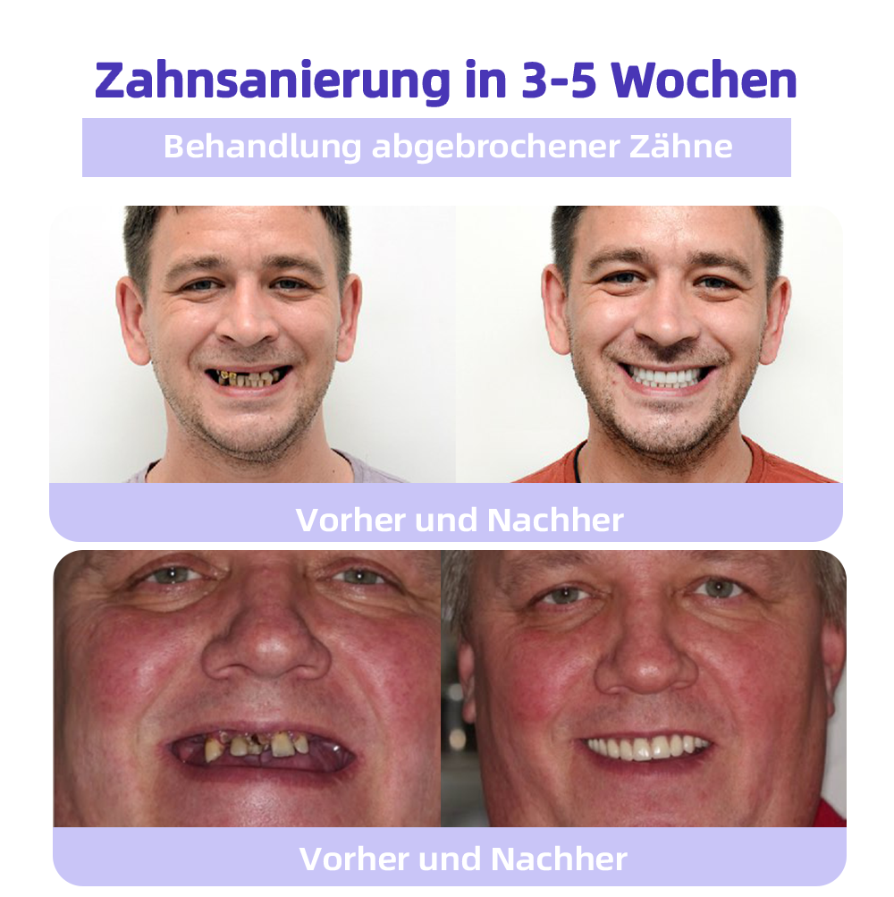 ✅Offizieller Shop: Oyikey™🌱Zahnreparatur-Mineralpulver 👨⚕️ Empfohlen von der Deutschen Zahnärztekammer (wirkt effektiv gegen Karies, Zahnfleischerkrankungen, Zahnsensibilität, Mundgeschwüre, gelbe Zähne und verbessert die Mundgesundheit)