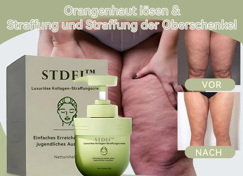 STDEI™ Luxus Kollagen Festigungscreme🌻