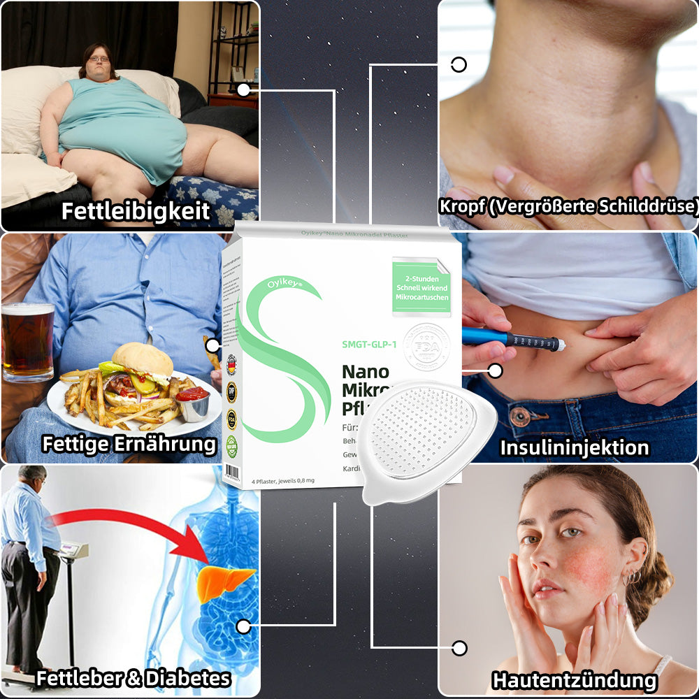 【BfArM-Zertifizierung ohne Nebenwirkungen】💉Oyikey®SMGT-GLP-1 Nano-Mikronadel-Pflaster（Schmerzfrei, lang anhaltend, gegen Diabetes, Fettleibigkeit und Herz-Kreislauf-Erkrankungen👨‍🔬）