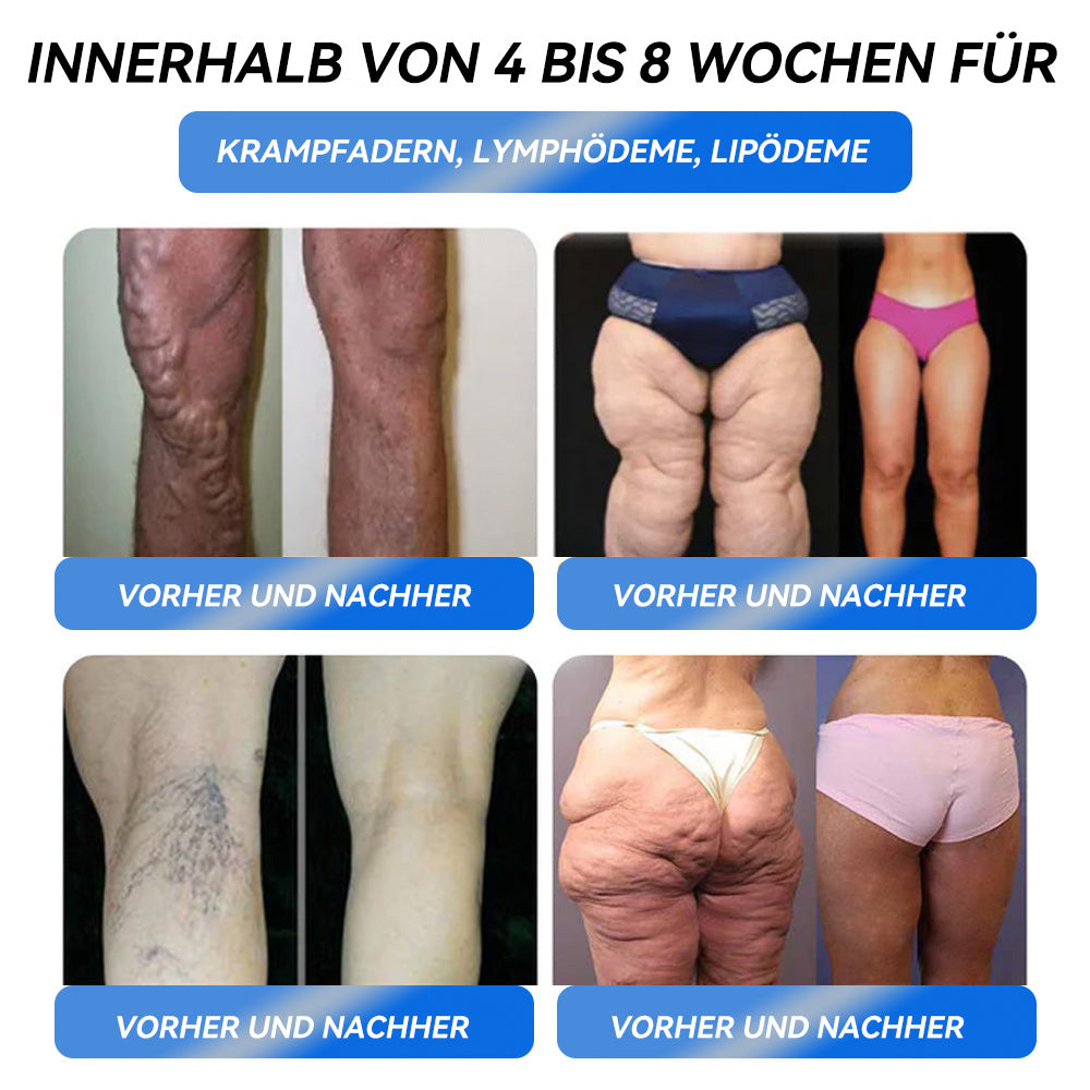 IFMAGIC® GLP-1 Pro Schlankheits-Trinklösung💦