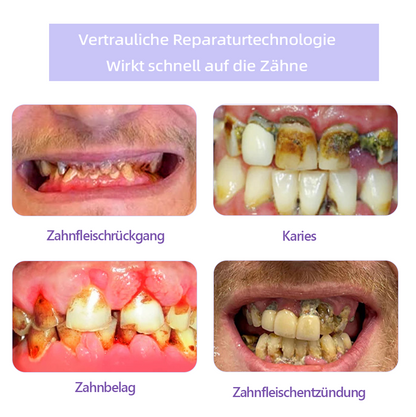 ✅Offizieller Shop: Oyikey™🌱Zahnreparatur-Mineralpulver 👨‍⚕️ Empfohlen von der Deutschen Zahnärztekammer (wirkt effektiv gegen Karies, Zahnfleischerkrankungen, Zahnsensibilität, Mundgeschwüre, gelbe Zähne und verbessert die Mundgesundheit)
