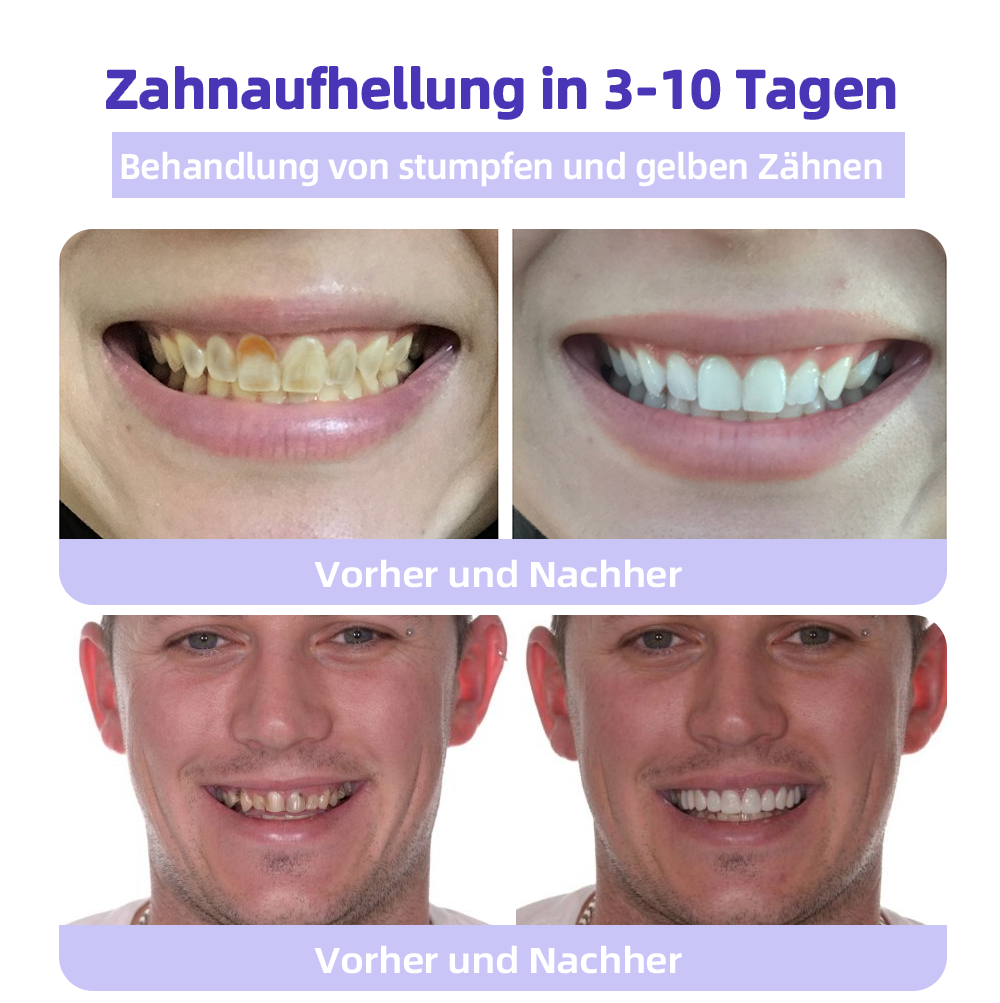 ✅Offizieller Shop: Oyikey™🌱Zahnreparatur-Mineralpulver 👨‍⚕️ Empfohlen von der Deutschen Zahnärztekammer (wirkt effektiv gegen Karies, Zahnfleischerkrankungen, Zahnsensibilität, Mundgeschwüre, gelbe Zähne und verbessert die Mundgesundheit)
