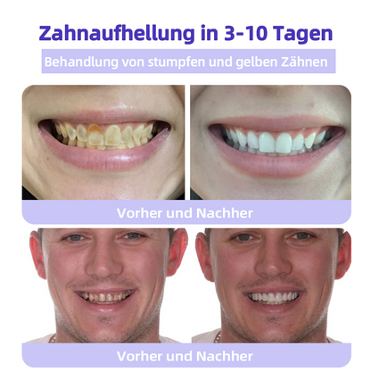 ✅Offizieller Shop: Oyikey™🌱Zahnreparatur-Mineralpulver 👨‍⚕️ Empfohlen von der Deutschen Zahnärztekammer (wirkt effektiv gegen Karies, Zahnfleischerkrankungen, Zahnsensibilität, Mundgeschwüre, gelbe Zähne und verbessert die Mundgesundheit)