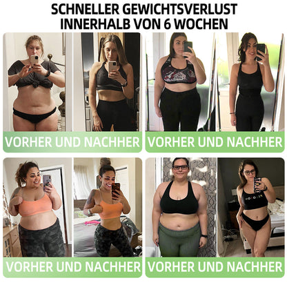 【BfArM-Zertifizierung ohne Nebenwirkungen】💉Oyikey®SMGT-GLP-1 Nano-Mikronadel-Pflaster（Schmerzfrei, lang anhaltend, gegen Diabetes, Fettleibigkeit und Herz-Kreislauf-Erkrankungen👨‍🔬）