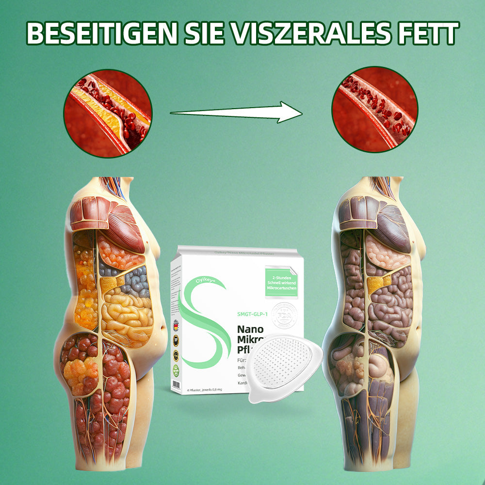 【BfArM-Zertifizierung ohne Nebenwirkungen】💉Oyikey®SMGT-GLP-1 Nano-Mikronadel-Pflaster（Schmerzfrei, lang anhaltend, gegen Diabetes, Fettleibigkeit und Herz-Kreislauf-Erkrankungen👨‍🔬）