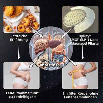 【BfArM-Zertifizierung ohne Nebenwirkungen】💉Oyikey®SMGT-GLP-1 Nano-Mikronadel-Pflaster（Schmerzfrei, lang anhaltend, gegen Diabetes, Fettleibigkeit und Herz-Kreislauf-Erkrankungen👨‍🔬）